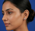 Semi Fancy Earring